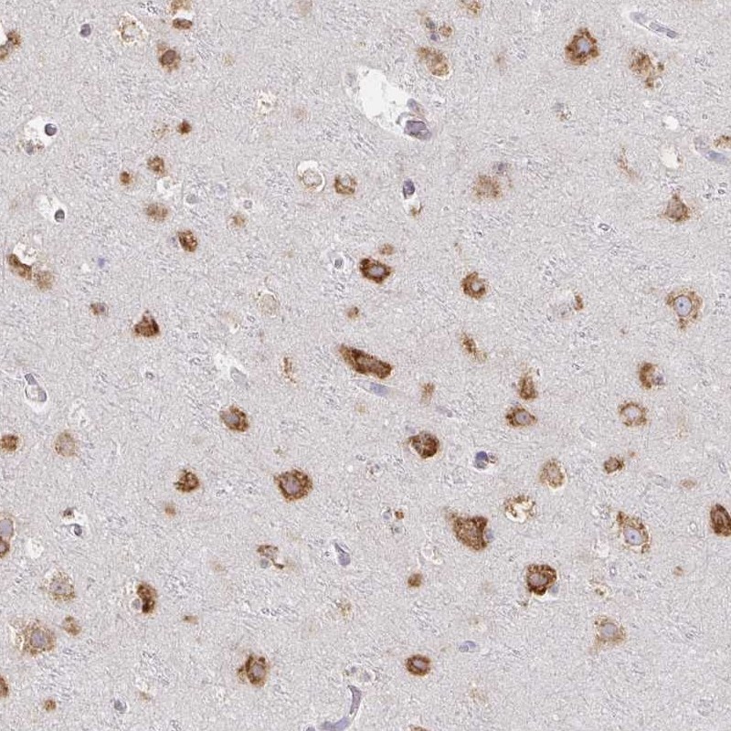 Atlas Antibodies Anti-NOMO1 Antibody
