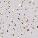 Atlas Antibodies Anti-NOMO1 Antibody