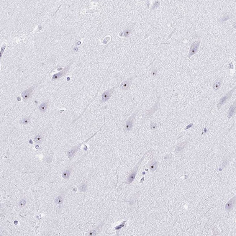 Atlas Antibodies Anti-NOP10 Antibody