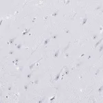 Atlas Antibodies Anti-NOP10 Antibody