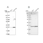 Atlas Antibodies Anti-NOP16 Antibody