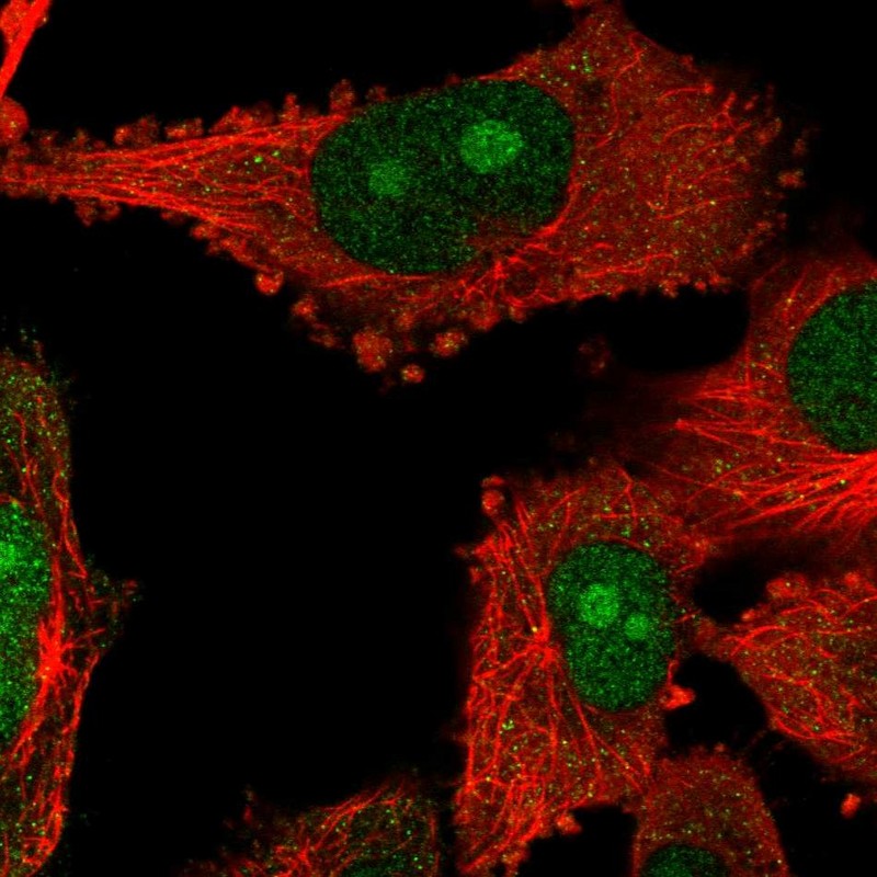 Atlas Antibodies Anti-NOP14 Antibody