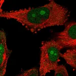 Atlas Antibodies Anti-NOP14 Antibody