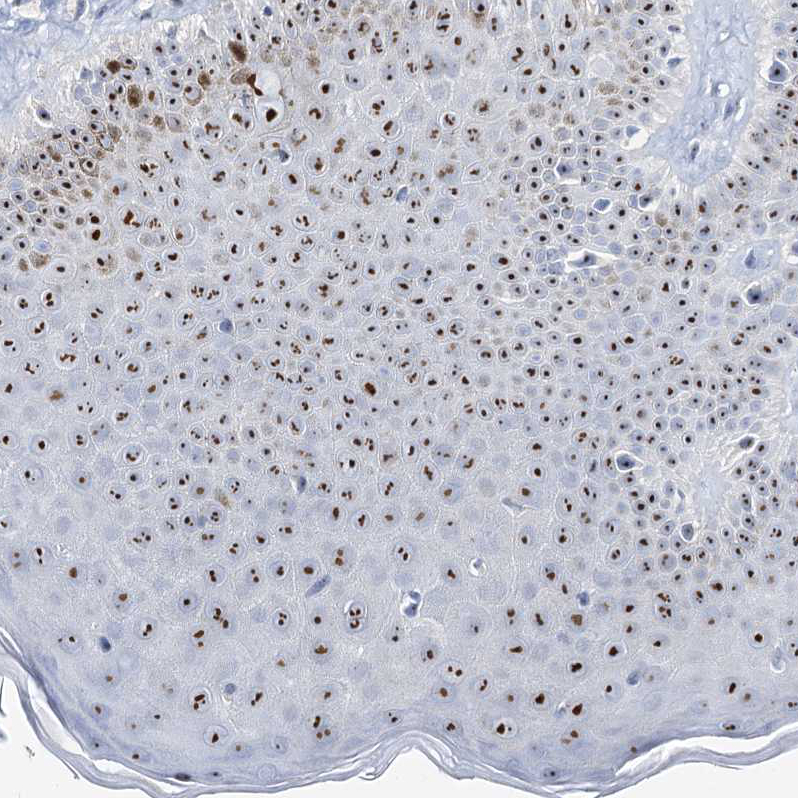 Atlas Antibodies Anti-NOP2 Antibody