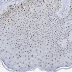 Atlas Antibodies Anti-NOP2 Antibody