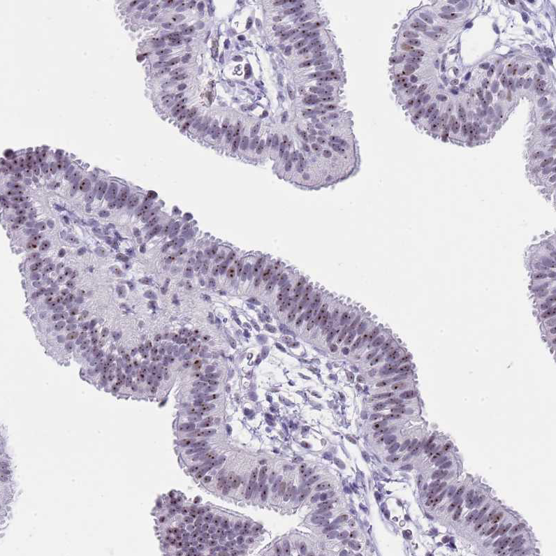 Atlas Antibodies Anti-NOP56 Antibody