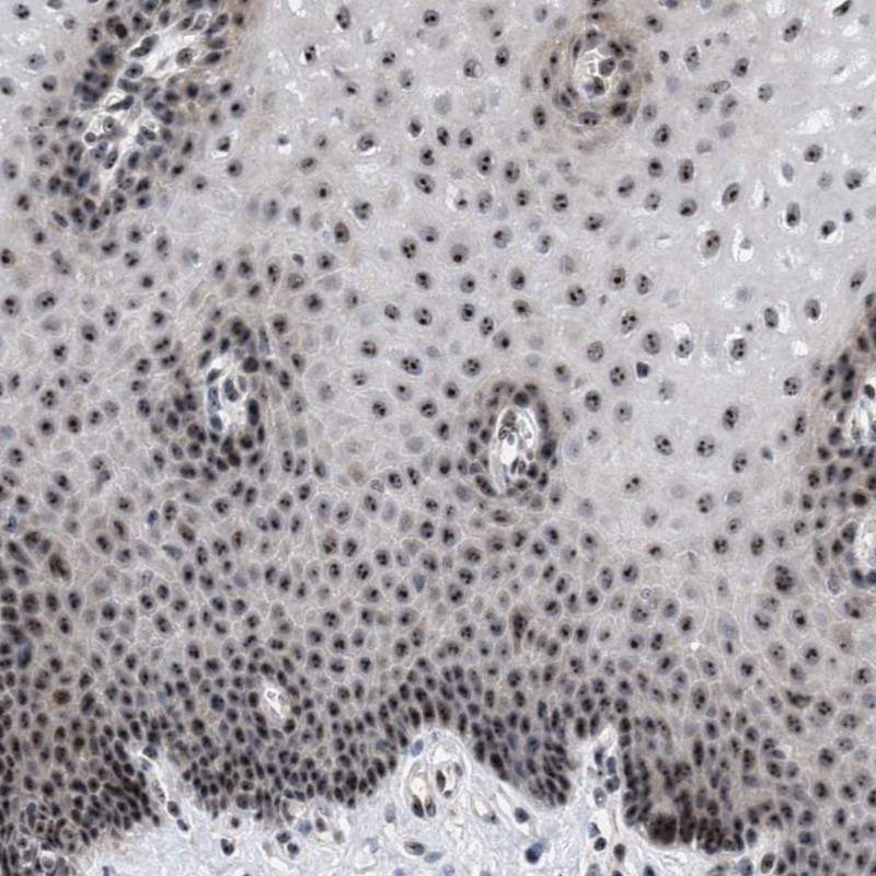 Atlas Antibodies Anti-NOP58 Antibody