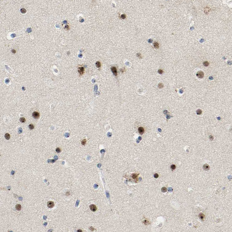 Atlas Antibodies Anti-NOP58 Antibody