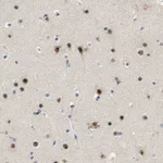 Atlas Antibodies Anti-NOP58 Antibody