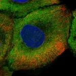 Atlas Antibodies Anti-NOS1 Antibody