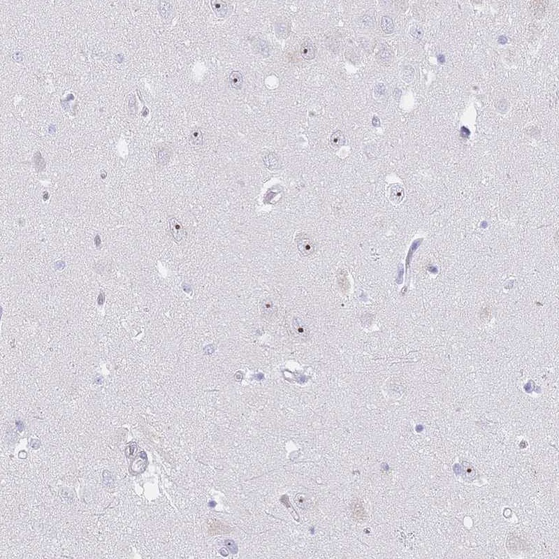 Atlas Antibodies Anti-NOP14 Antibody