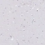 Atlas Antibodies Anti-NOP14 Antibody