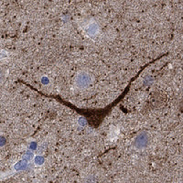 Atlas Antibodies Anti-NOS1 Antibody