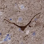 Atlas Antibodies Anti-NOS1 Antibody