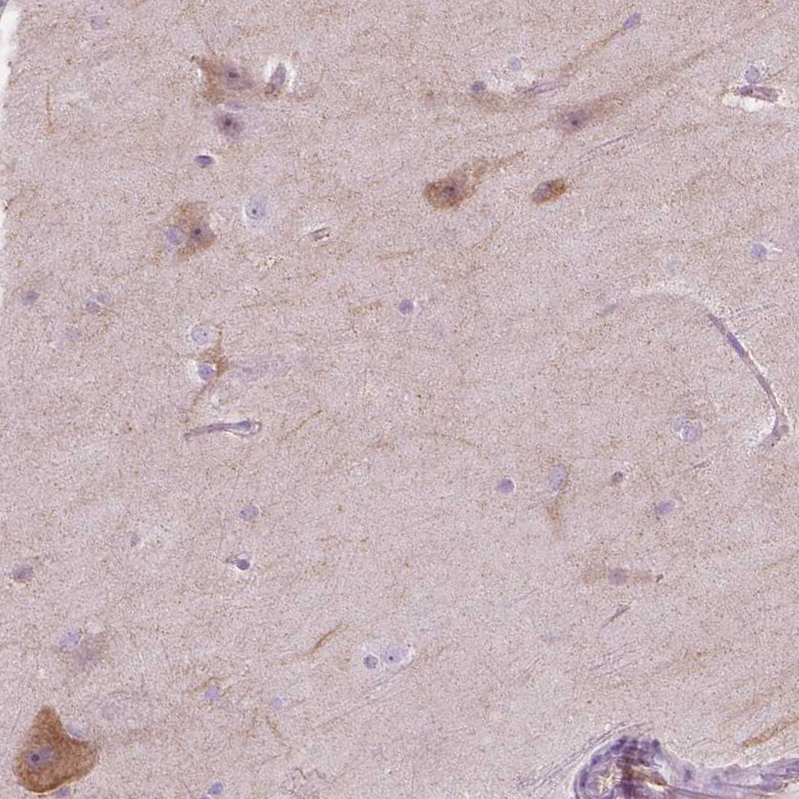 Atlas Antibodies Anti-NOS1AP Antibody