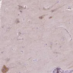 Atlas Antibodies Anti-NOS1AP Antibody