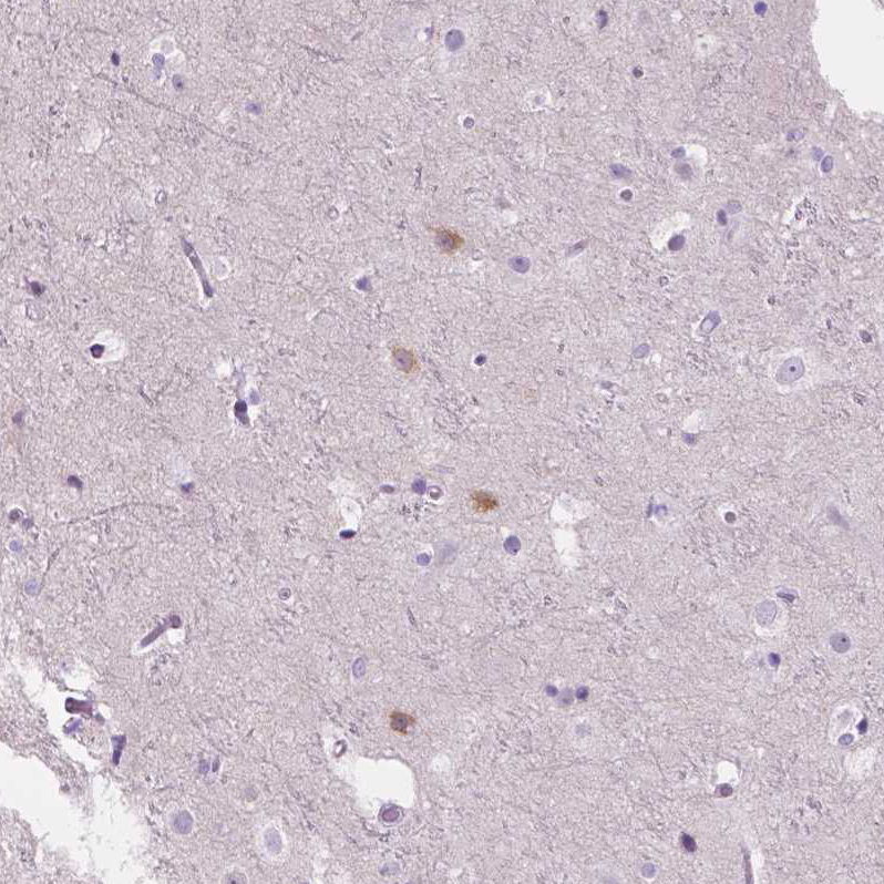 Atlas Antibodies Anti-NOS1AP Antibody