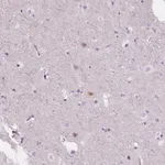 Atlas Antibodies Anti-NOS1AP Antibody