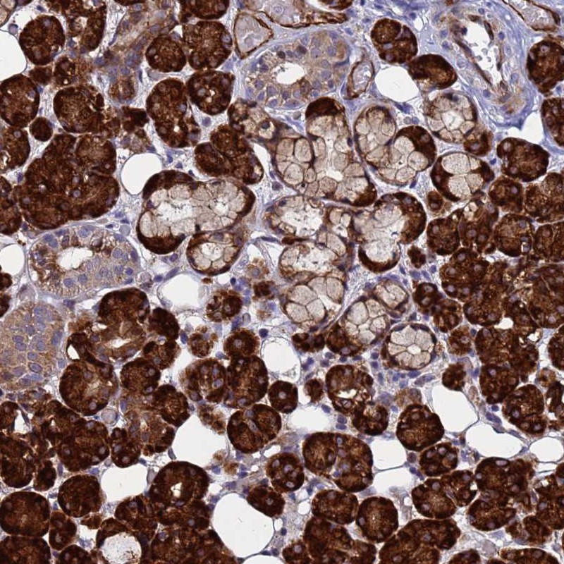 Atlas Antibodies Anti-NOSTRIN Antibody