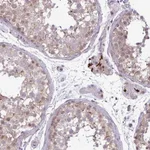 Atlas Antibodies Anti-NOTCH2 Antibody