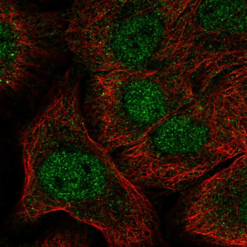 Atlas Antibodies Anti-NOTCH1 Antibody