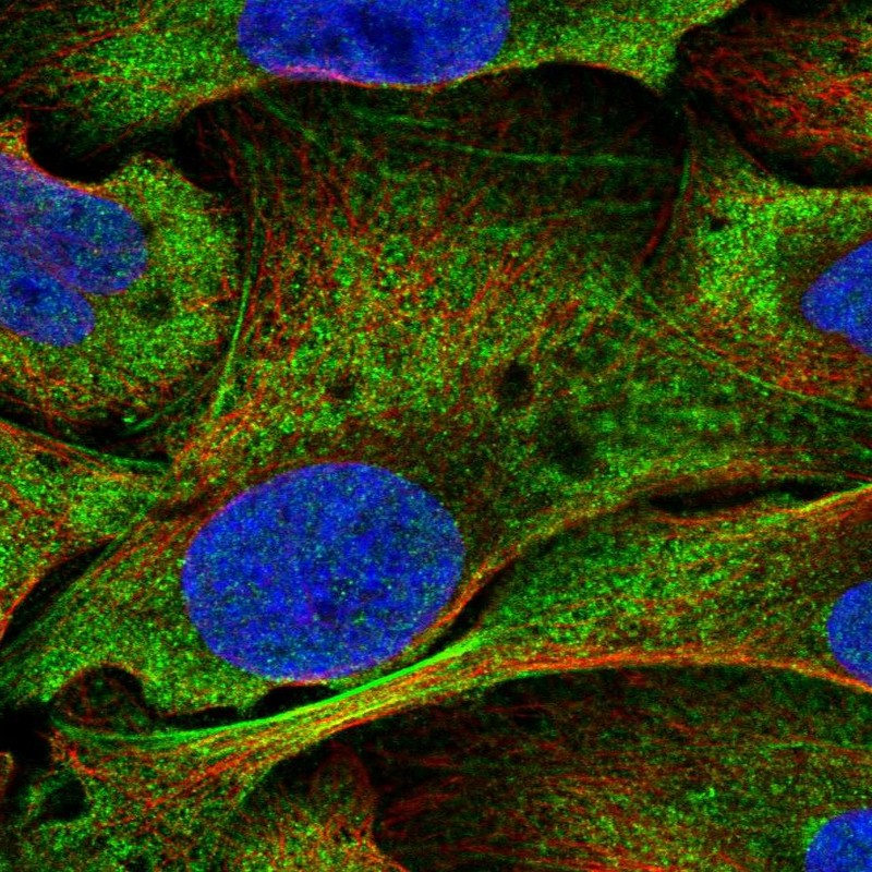 Atlas Antibodies Anti-NOTCH3 Antibody