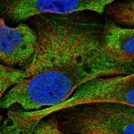Atlas Antibodies Anti-NOTCH3 Antibody