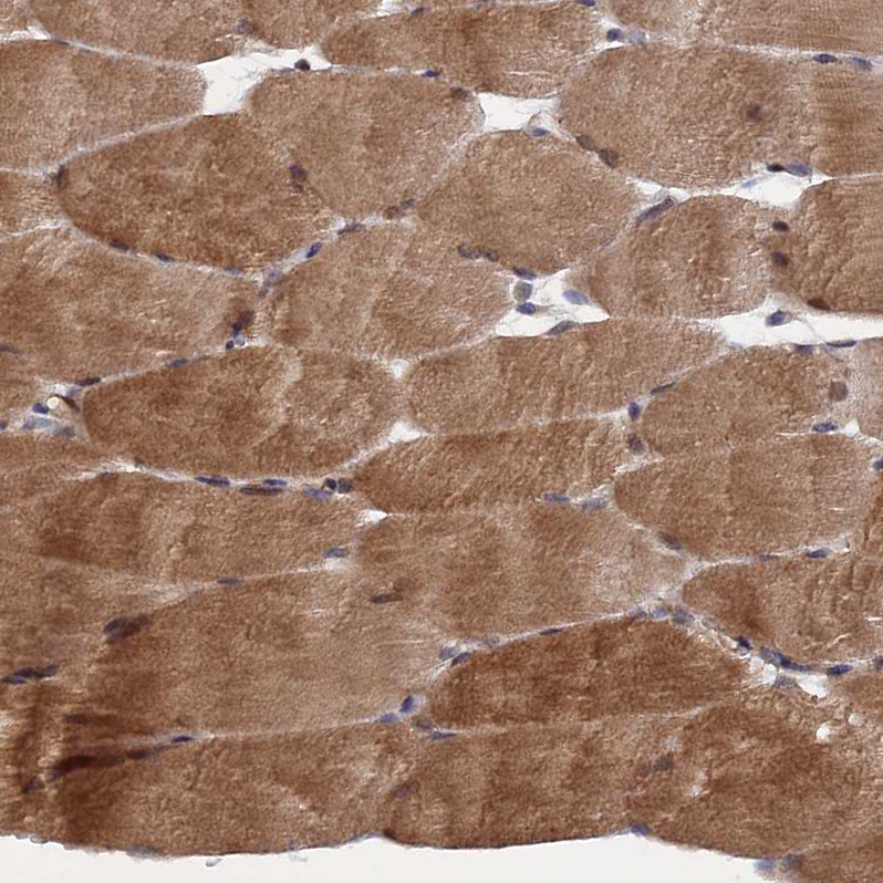 Atlas Antibodies Anti-NOSIP Antibody