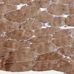 Atlas Antibodies Anti-NOSIP Antibody