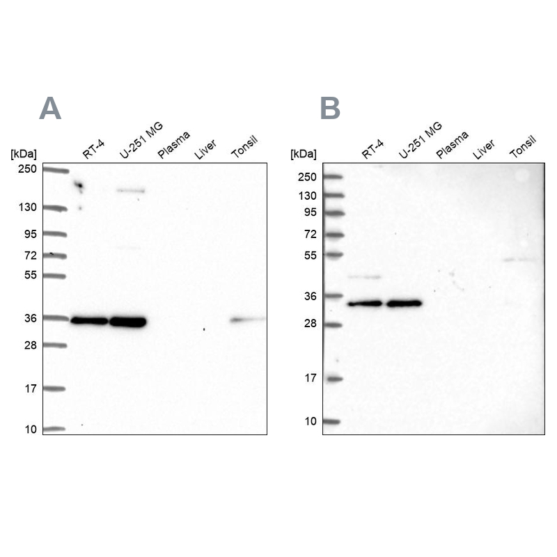 Atlas Antibodies Anti-NOSIP Antibody