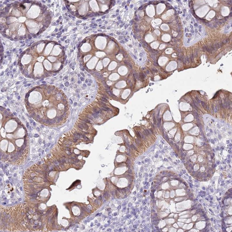 Atlas Antibodies Anti-NPAP1 Antibody