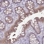 Atlas Antibodies Anti-NPAP1 Antibody