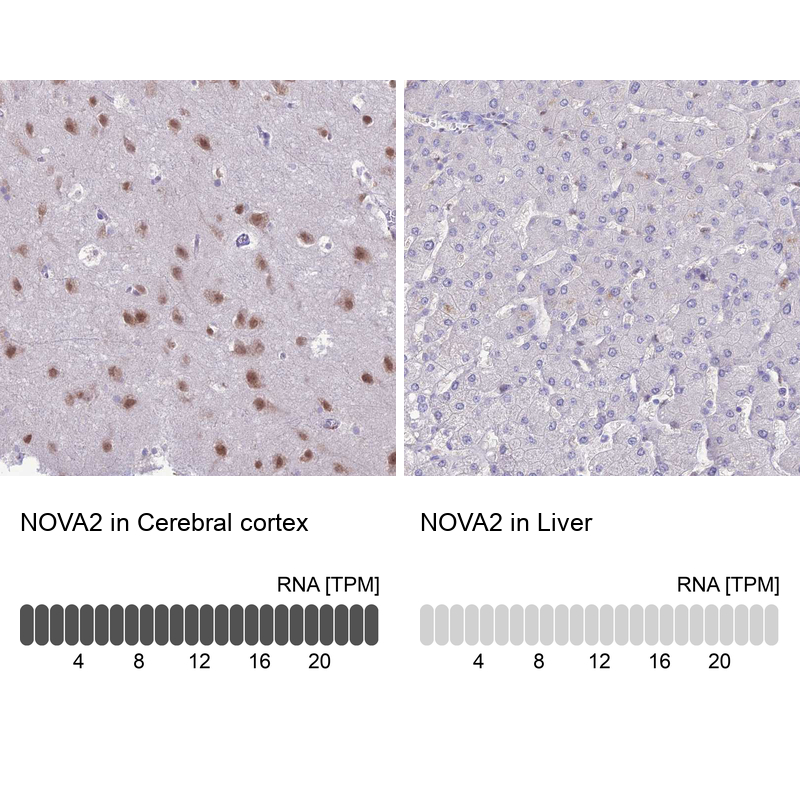 Atlas Antibodies Anti-NOVA2 Antibody