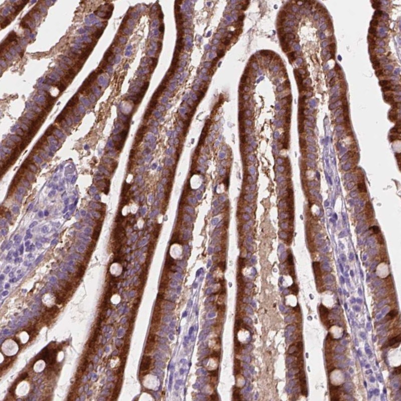 Atlas Antibodies Anti-NOXO1 Antibody