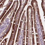 Atlas Antibodies Anti-NOXO1 Antibody