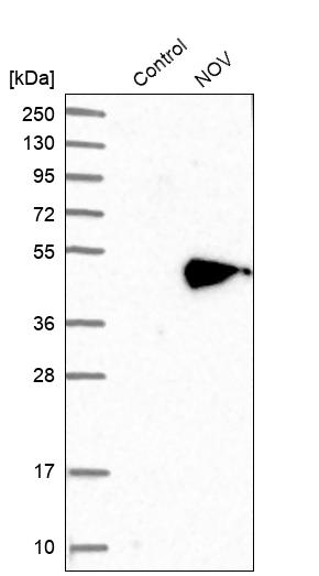 Atlas Antibodies Anti-NOV Antibody