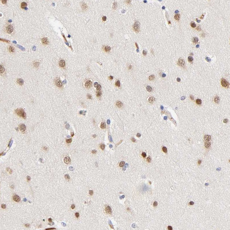 Atlas Antibodies Anti-NOVA1 Antibody