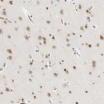 Atlas Antibodies Anti-NOVA1 Antibody