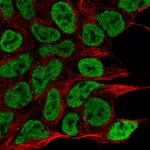 Atlas Antibodies Anti-NPAS1 Antibody