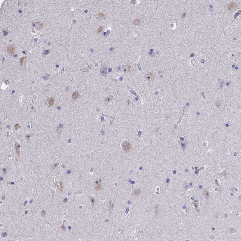 Atlas Antibodies Anti-NOXRED1 Antibody