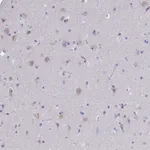 Atlas Antibodies Anti-NOXRED1 Antibody