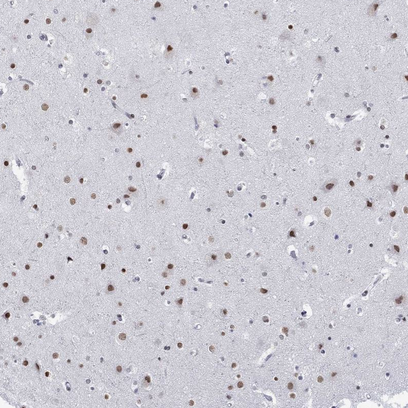 Atlas Antibodies Anti-NPAS3 Antibody