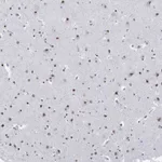Atlas Antibodies Anti-NPAS3 Antibody