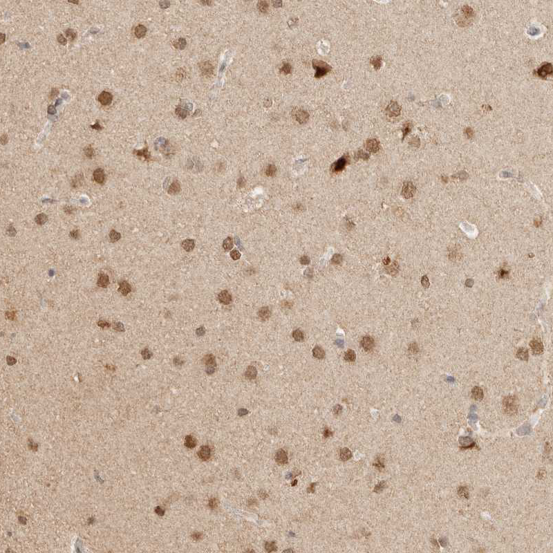 Atlas Antibodies Anti-NPAS2 Antibody