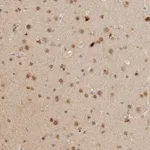 Atlas Antibodies Anti-NPAS2 Antibody