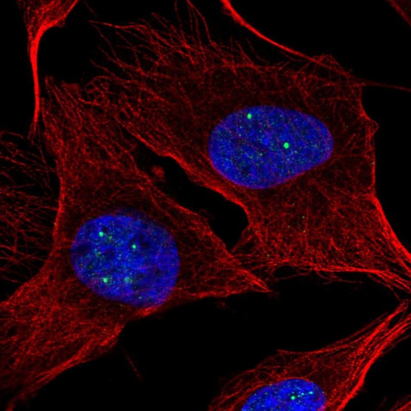 Atlas Antibodies Anti-NPAT Antibody