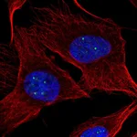 Atlas Antibodies Anti-NPAT Antibody
