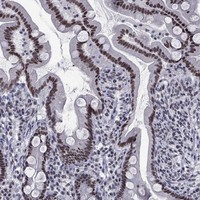 Atlas Antibodies Anti-NPAS3 Antibody