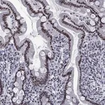 Atlas Antibodies Anti-NPAS3 Antibody