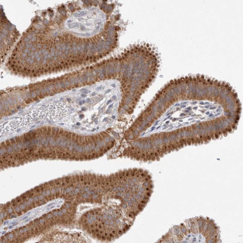 Atlas Antibodies Anti-NPC1 Antibody